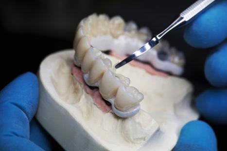 réparations dents charleroi